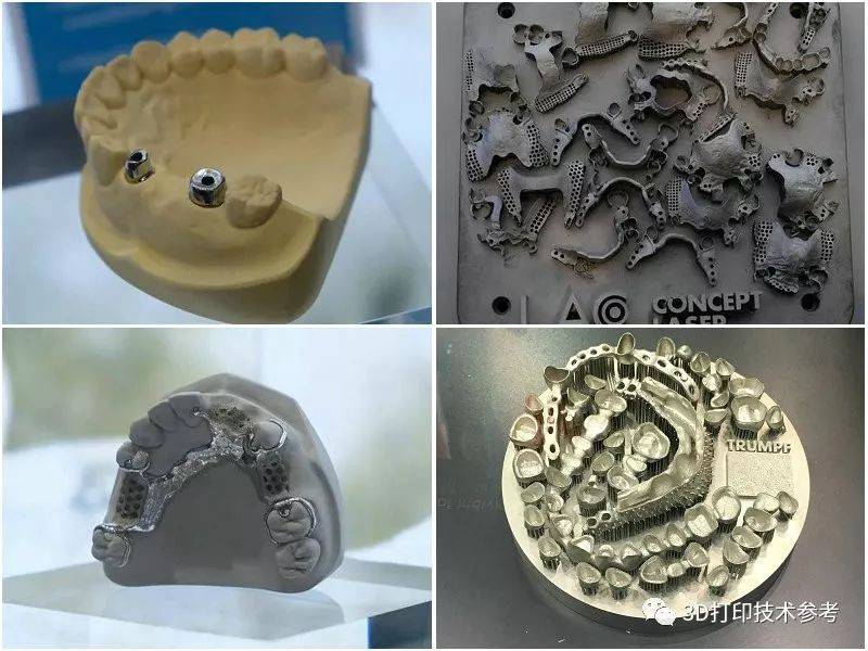 3D打印技术对模具制造技术的影响分析